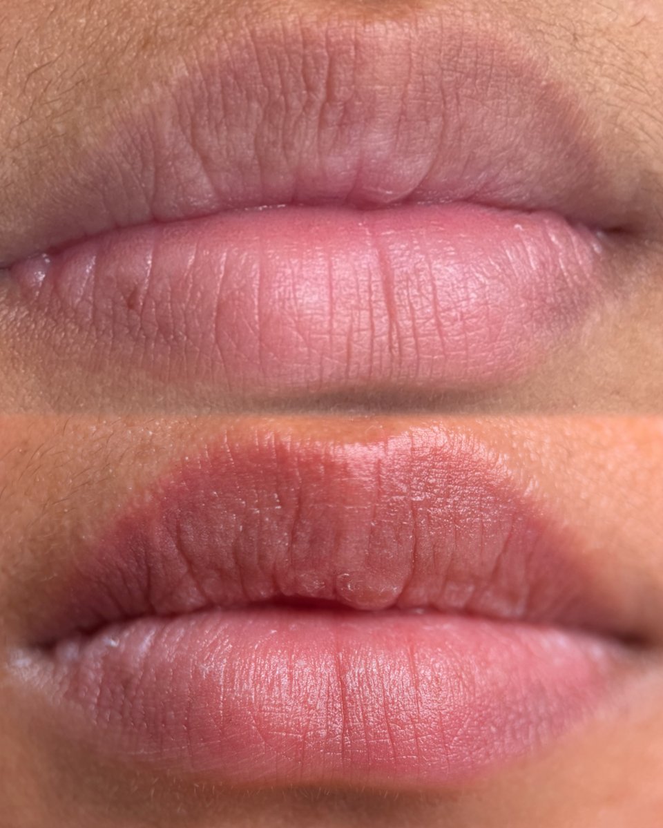 Lips before treatment and after healing, showing healed lip blushing results by PMU by the Sea
